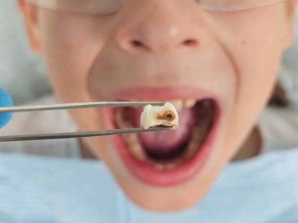 Best Pediatric Emergency Dentist in Manning, IA